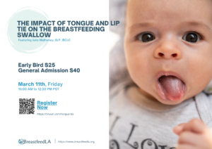 The Impact of Tongue and Lip Tie on the Breastfeeding Swallow @ Online